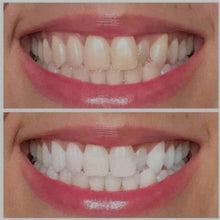 Load image into Gallery viewer, Ultra Violet Teeth Whitening Gel