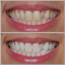 Load image into Gallery viewer, Ultra Violet Teeth Whitening Gel
